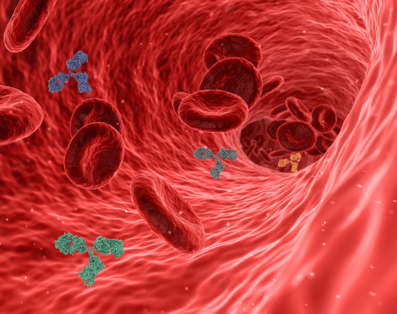 ANEMIAS